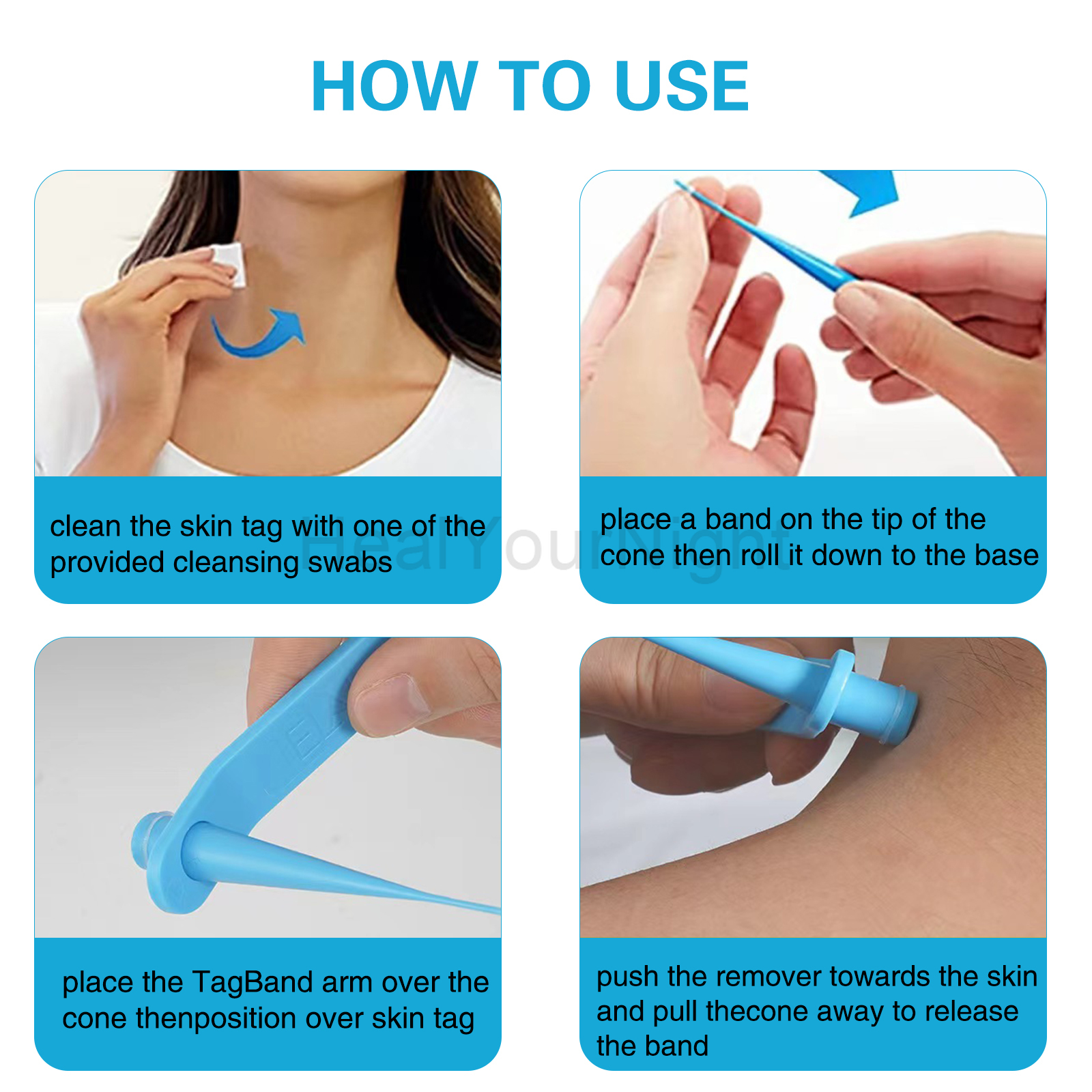 3-IN-1 Auto Skin Tag Removal K - Luxury Skincare Acne ulasan dan harga