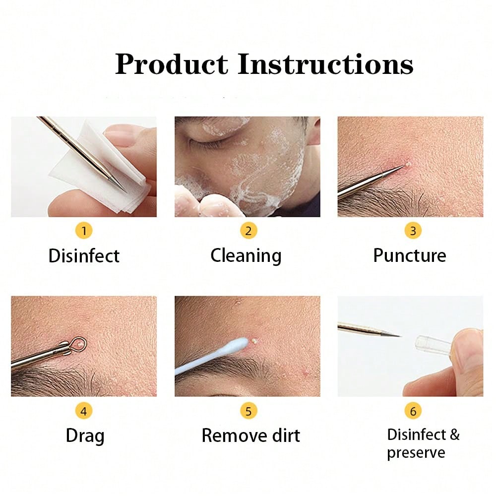 4-piece stainless steel comedo - Luxury Skincare Acne ulasan dan harga