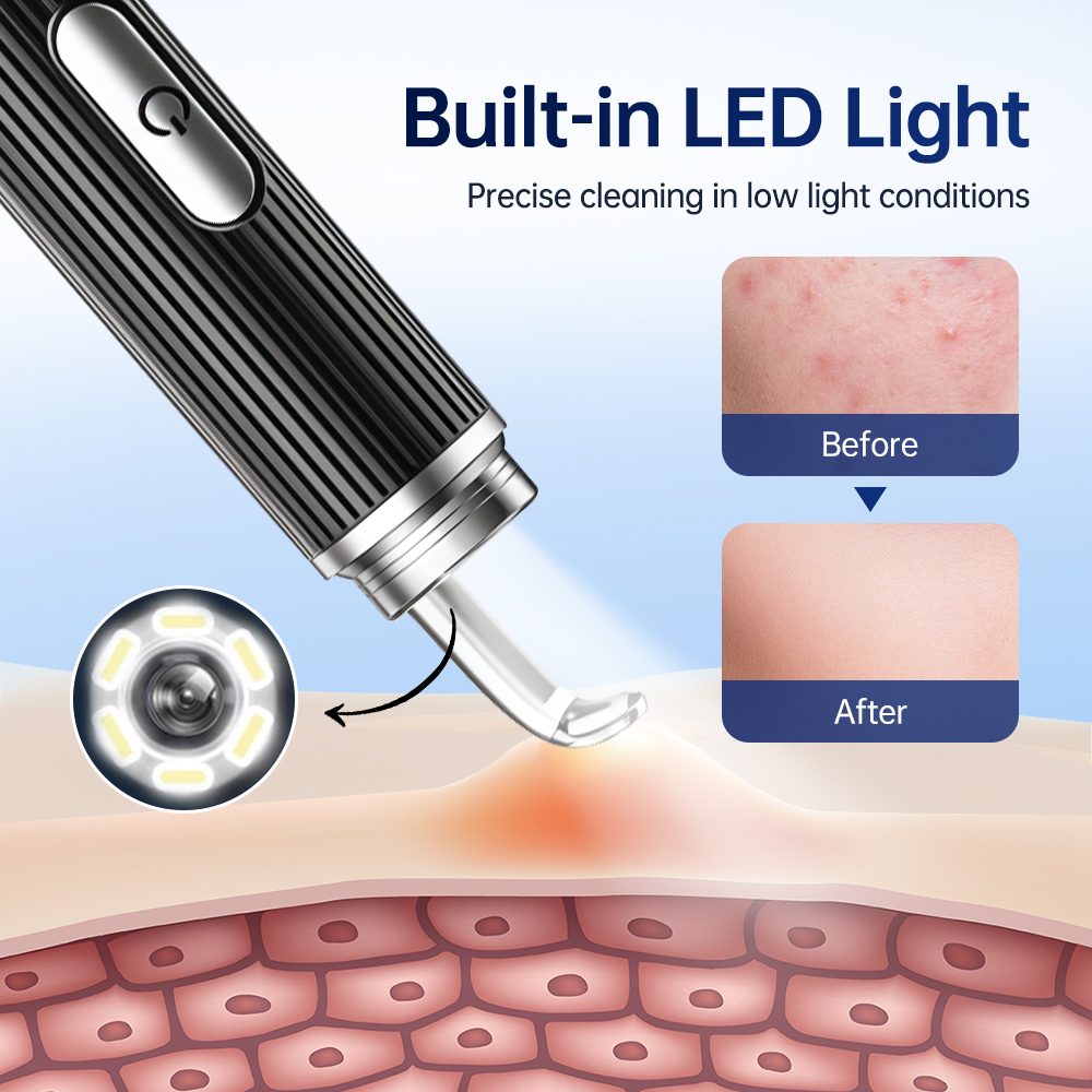 Visual Blackhead Remover with  - Luxury Skincare Acne ulasan dan harga